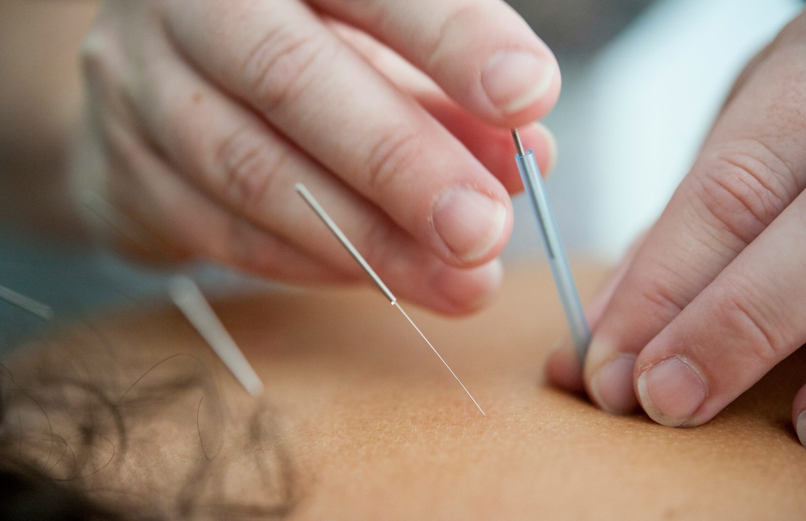 Chiropractor in Milton