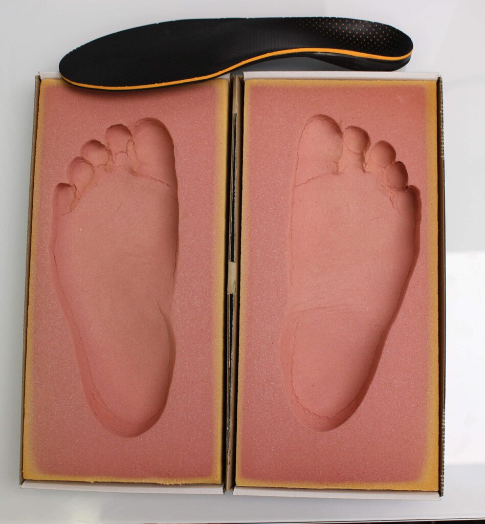 Custom Orthotics at Carriage Square Chiropractic in Milton
